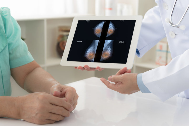 Estudio de mamografía por médico y paciente