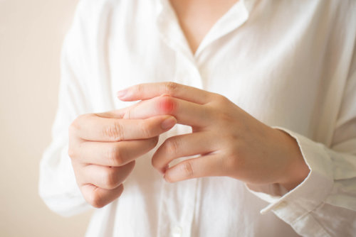 La inflamación de los dedos de las manos puede ser un síntoma de esclerodermia