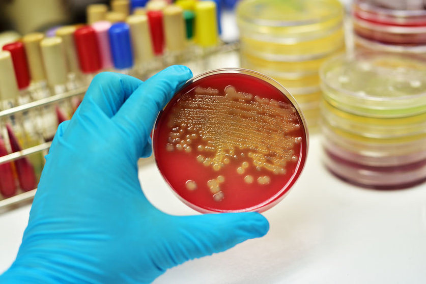 49886319 - colony of bacteria in culture medium plate